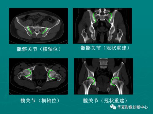 学习必备丨骨骼肌肉系统医学影像解剖