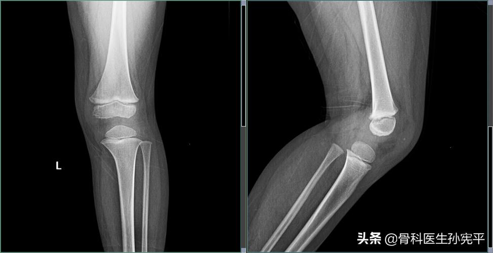 医学影像图片共享 机遇、挑战与未来展望